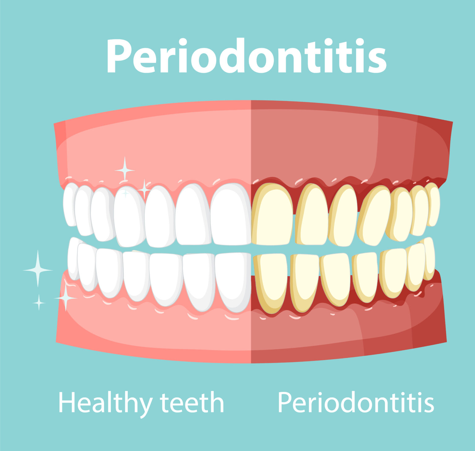 Diabetes And Periodontal Disease 3 Treatment Facts For You Ricci