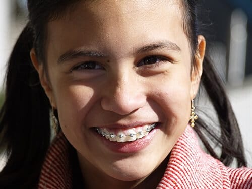 young girl on the way to straighten your smile with a set of orthodontic braces