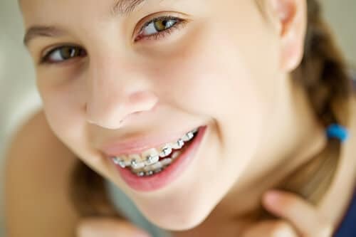 young girl with braces after discussing the oral hygiene topic for orthodontic braces