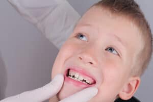 young boy learns about the treatments available for crooked teeth
