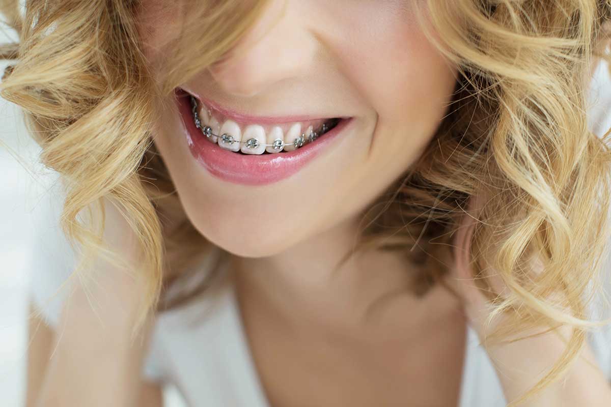 Woman smiles as she thinks about caring for braces
