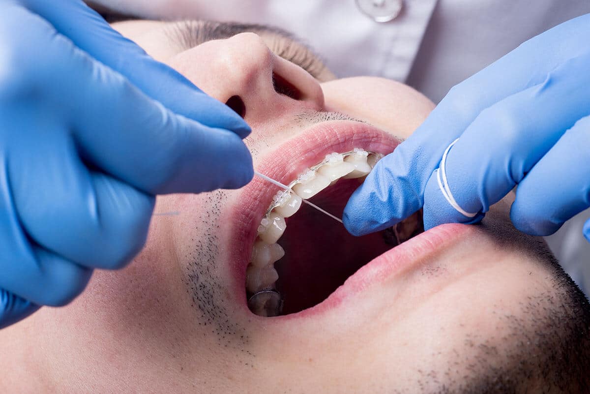 close up of dentist helping patient flossing with braces