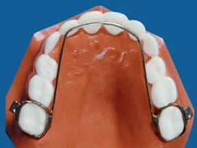 Ricci Orthodontics Arch