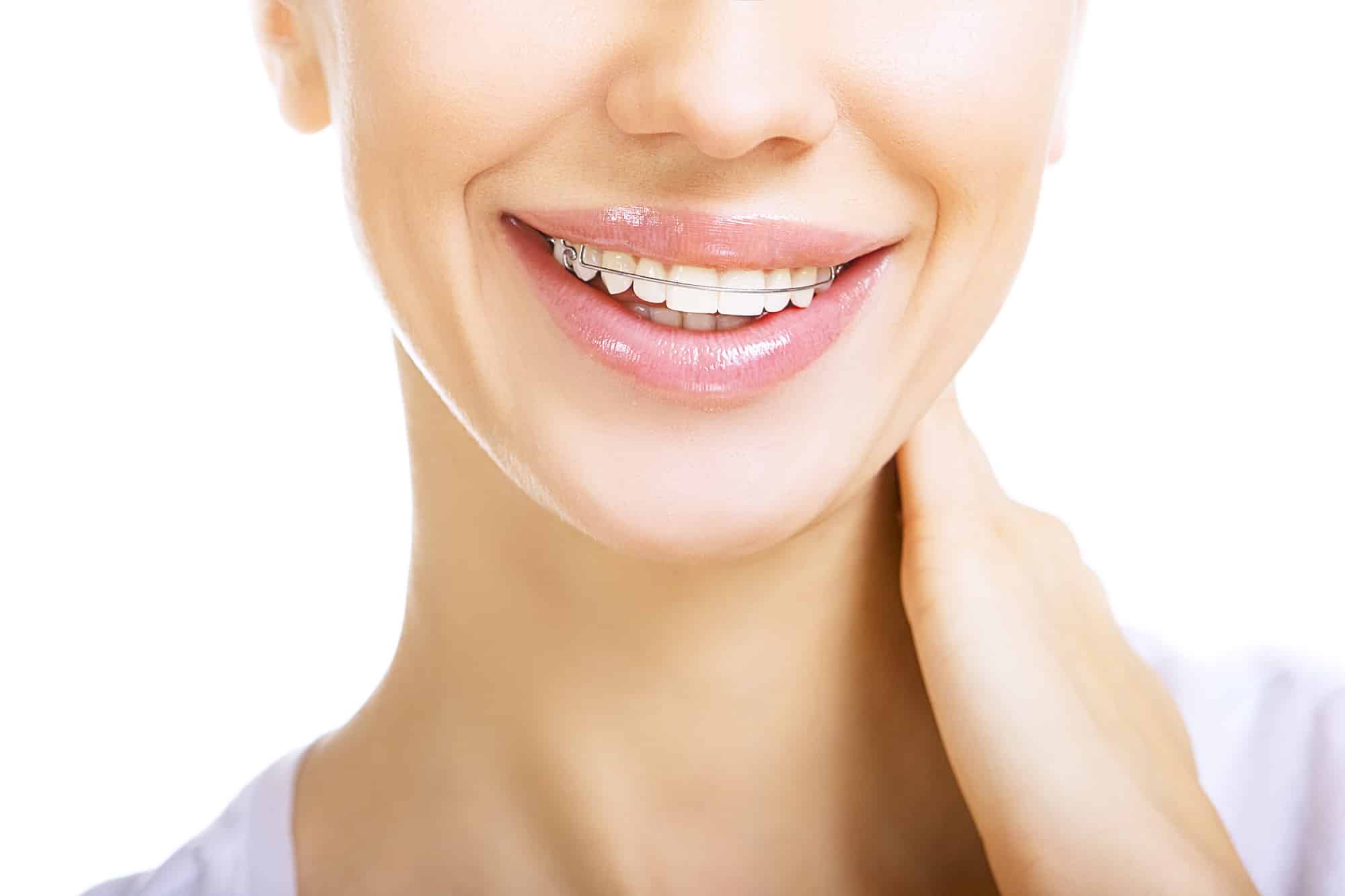 Why Wearing A Retainer Is Important—everything You Need To Know Ricci Orthodontics