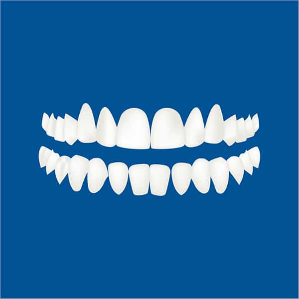 Level 3 of Treatment For Clear Aligners