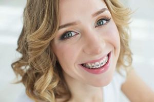 Adults-And-Braces Adults And Braces