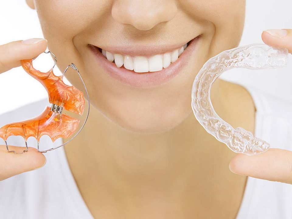 What Retainer is Right for You