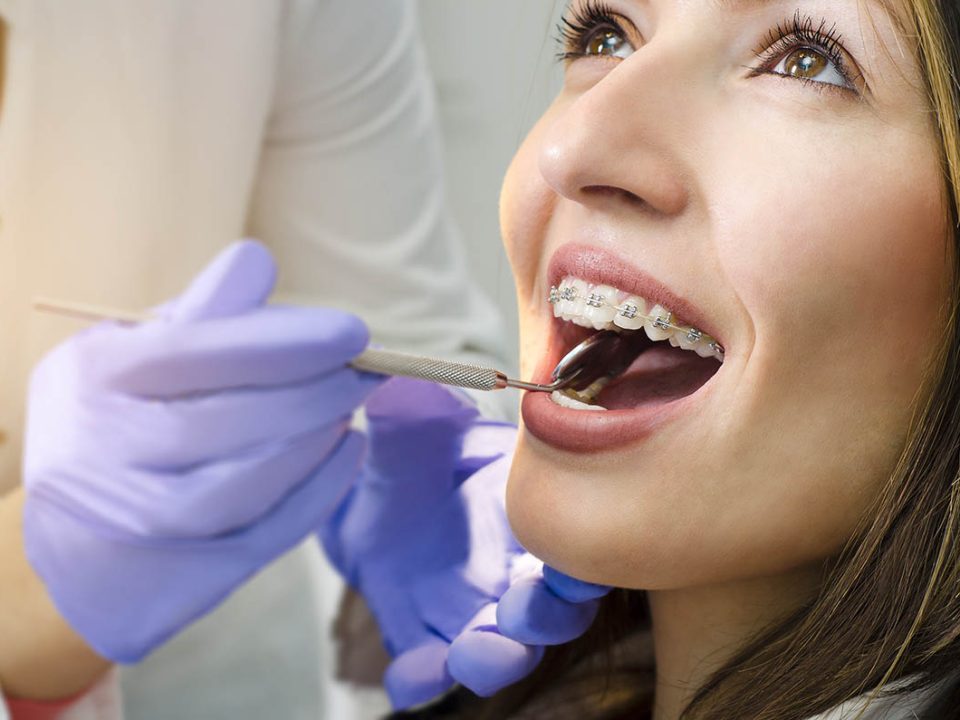 benefits of orthodontics