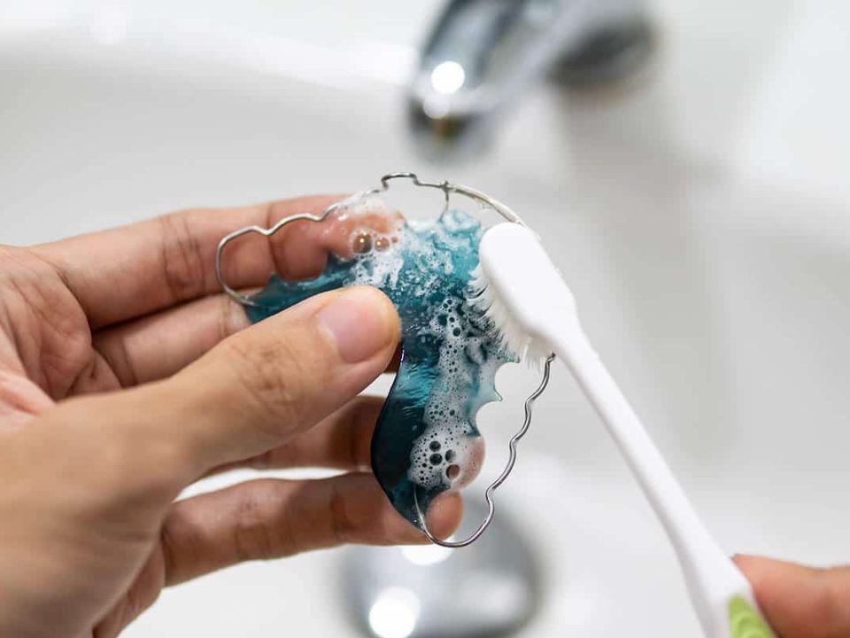 cleaning a retainer