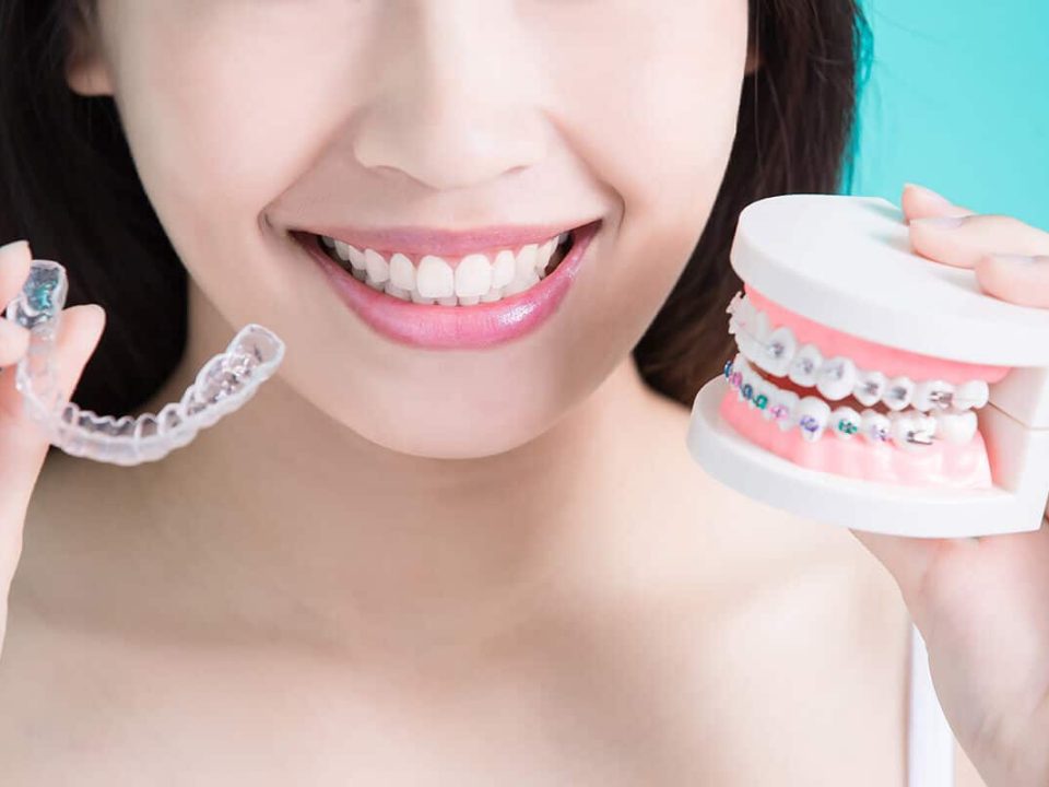 how to straighten teeth