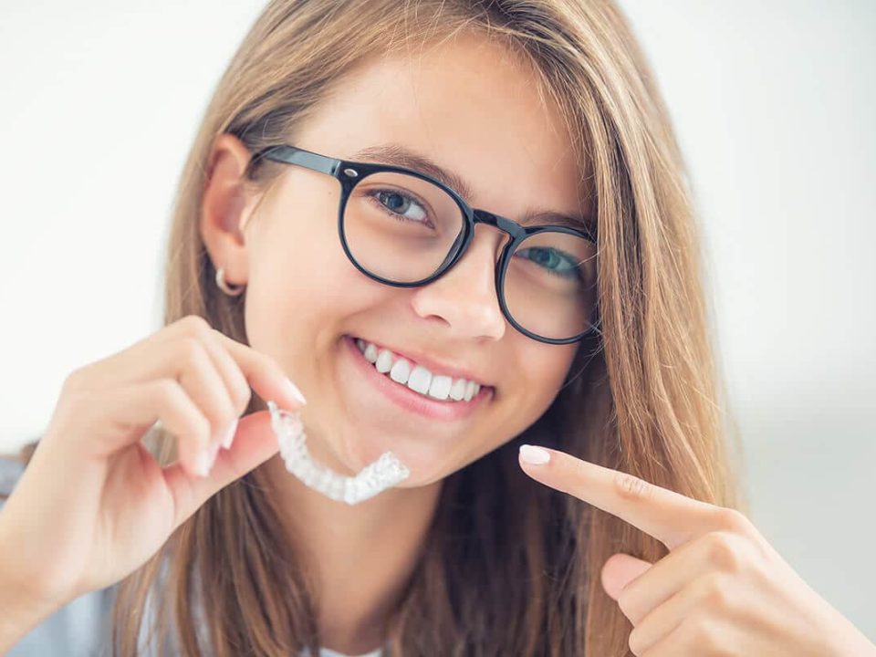 invisalign results