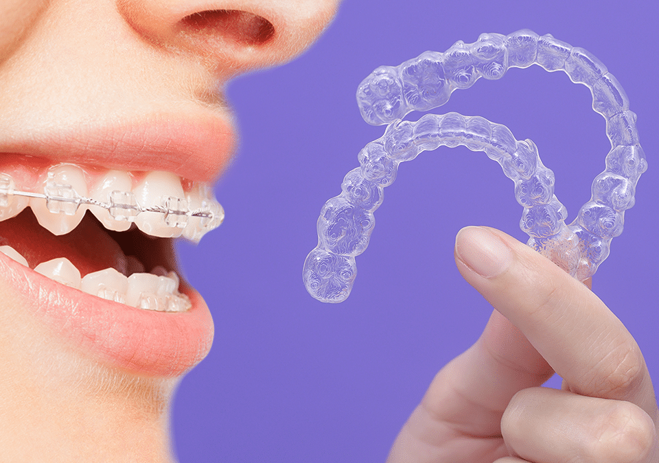 invisalign vs braces
