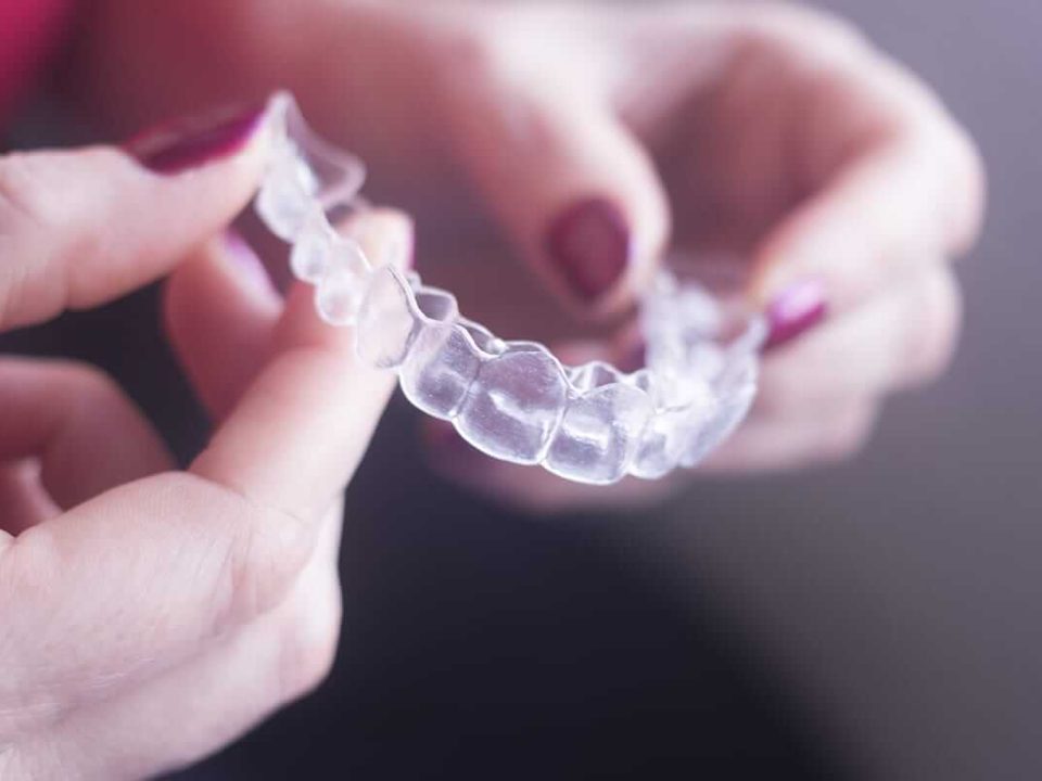 straighten teeth without braces (1)