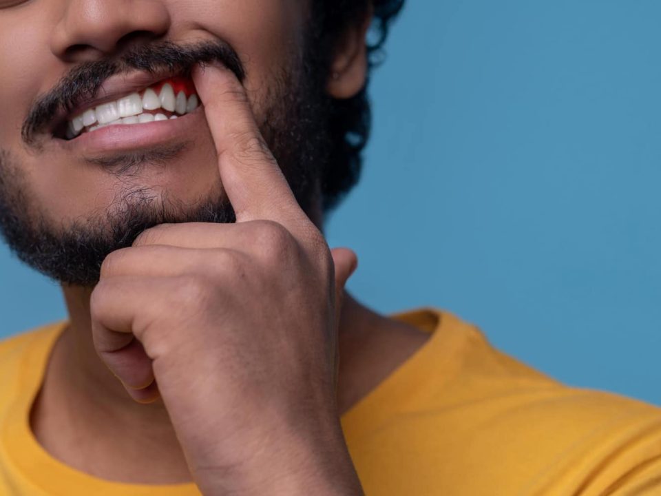 types of malocclusions ortho 1