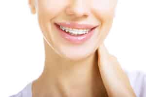 wearing a retainer important 1 300x200